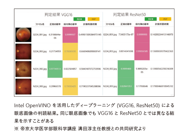 Intel OpenVINOを活用した眼底画像の判読結果