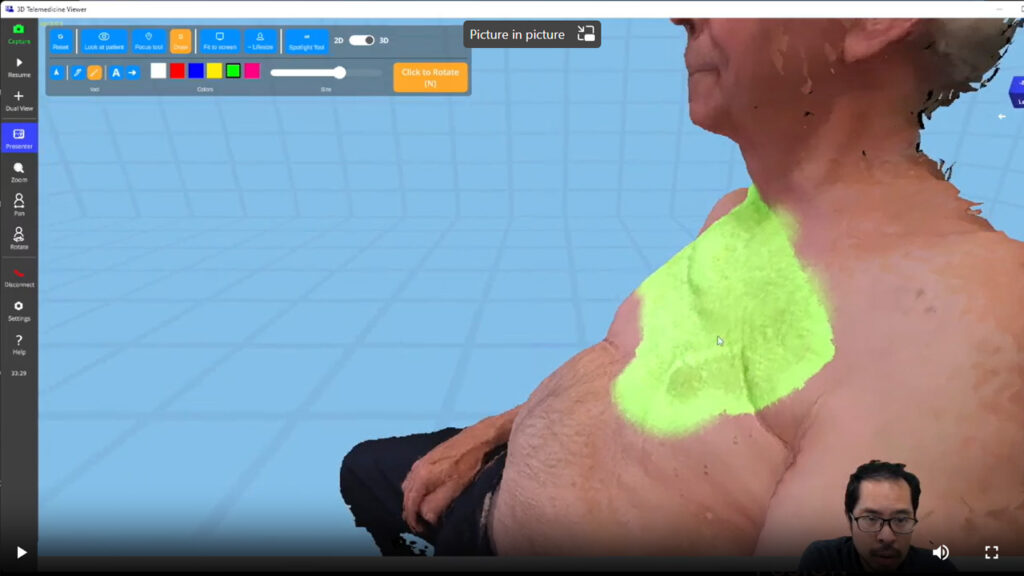 3D Telemedicine viewer functionalities - close-up of a patient's chest area highlighted
