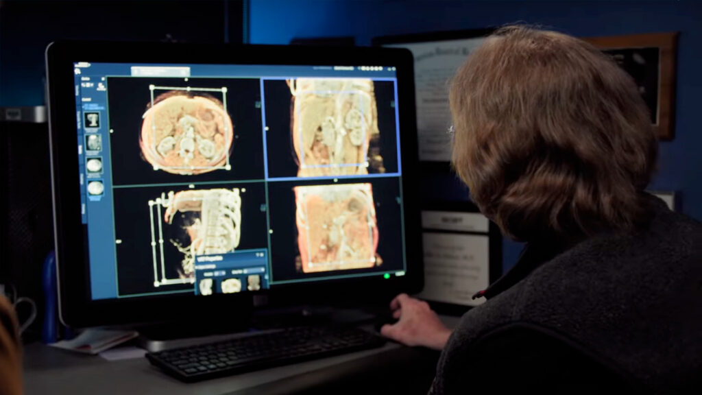AI4Good - Expand Opportunity | photo of a person reviewing four scans of a pancreas and surrounding areas