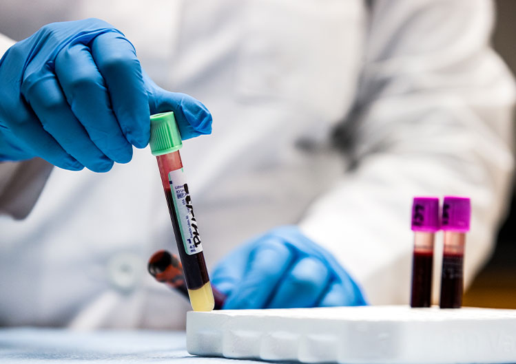 Close-up of medical lab technician‘s gloved hands placing vial of blood in vial rack.